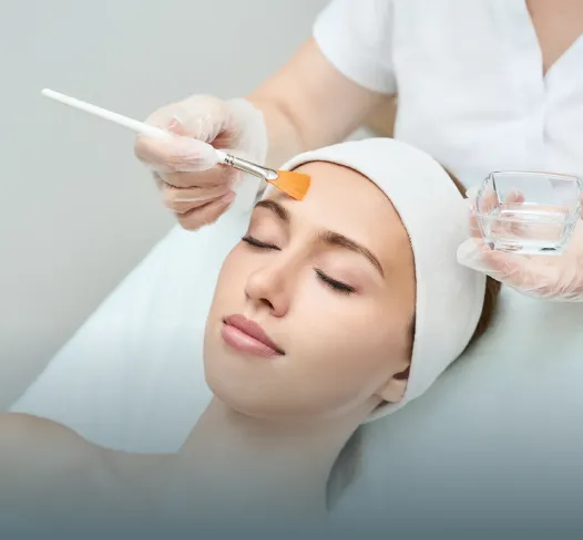 Facial Peels